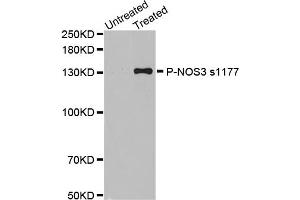Western Blotting (WB) image for anti-Nitric Oxide Synthase 3 (Endothelial Cell) (NOS3) (pSer1177) antibody (ABIN1870485) (ENOS Antikörper  (pSer1177))