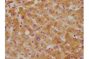 IHC image of ABIN7127423 diluted at 1:115 and staining in paraffin-embedded human liver tissue performed on a Leica BondTM system. (Rekombinanter CETP Antikörper)