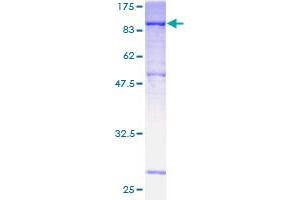 Image no. 1 for Dystrophia Myotonica-Protein Kinase (DMPK) (AA 1-629) protein (GST tag) (ABIN1351723) (DMPK Protein (AA 1-629) (GST tag))