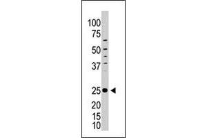 The ICOS polyclonal antibody  is used in Western blot to detect ICOS in HL-60 cell lysate. (ICOS Antikörper  (C-Term))