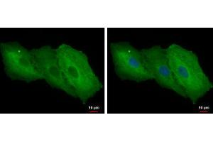 Immunofluorescence (IF) image for anti-Lectin, Galactoside-Binding, Soluble, 1 (LGALS1) antibody (ABIN2855093)