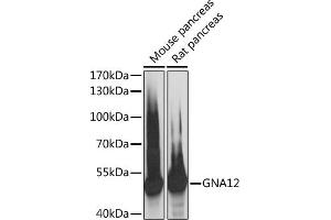 Western blot analysis of extracts of various cell lines, using GN antibody (ABIN6131706, ABIN6141192, ABIN6141193 and ABIN6217845) at 1:3000 dilution. (GNA12 Antikörper  (AA 1-200))