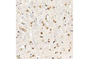 Immunohistochemistry (Paraffin-embedded Sections) (IHC (p)) image for anti-Hepatoma-Derived Growth Factor-Related Protein 3 (HDGFRP3) antibody (ABIN7074198)