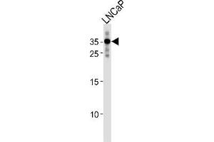 Western blot analysis in LNCaP cell line lysates (35ug/lane) using RNF4 Antibody (C-term) Cat. (RNF4 Antikörper  (C-Term))