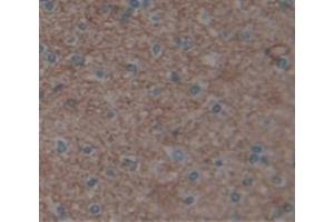 IHC-P analysis of Human Tissue, with DAB staining. (UACA Antikörper  (AA 29-209))