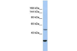 WB Suggested Anti-ZZZ3 Antibody Titration:  0. (ZZZ3 Antikörper  (Middle Region))