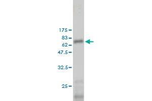 Western Blot detection against Immunogen (65. (LGALS8 Antikörper  (AA 1-358))