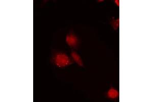 ABIN6272286 staining LOVO by IF/ICC. (RBM6 Antikörper  (N-Term))