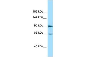 WB Suggested Anti-Epha4 Antibody Titration: 1. (EPH Receptor A4 Antikörper  (C-Term))