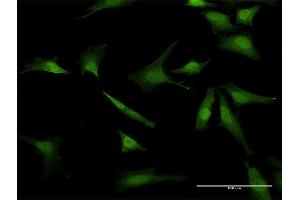 Immunofluorescence of purified MaxPab antibody to BIRC5 on HeLa cell. (Survivin Antikörper  (AA 1-142))