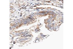 ABIN6266837 at 1/100 staining human lung tissue sections by IHC-P. (Claudin 7 Antikörper  (C-Term))