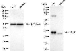 Western blotting analysis using Bcl-2 antibody (ABIN7797719). (Rekombinanter Bcl-2 Antikörper)