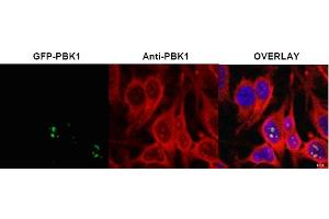 Image no. 1 for anti-Ribosomal L1 Domain Containing 1 (RSL1D1) (Internal Region) antibody (ABIN401398) (RSL1D1 Antikörper  (Internal Region))