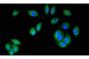 Immunofluorescence staining of A549 cells with ABIN7150721 at 1:200, counter-stained with DAPI. (MAP2K6 Antikörper  (AA 1-334))