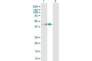 Western Blotting (WB) image for anti-Carbohydrate (Chondroitin 4) Sulfotransferase 11 (CHST11) (AA 230-337) antibody (ABIN565487)