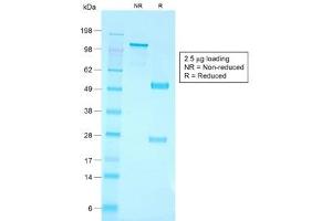 SDS-PAGE analysis of purified, BSA-free recombinant CD79a antibody (clone IGA/1790R) as confirmation of integrity and purity. (Rekombinanter CD79a Antikörper  (AA 202-216))