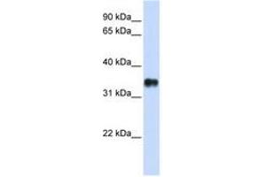 Image no. 1 for anti-Potassium Channel Tetramerisation Domain Containing 7 (KCTD7) (N-Term) antibody (ABIN6740422) (KCTD7 Antikörper  (N-Term))