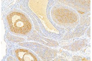 ABIN6259721 and ABIN6269341 at 1/100 staining Rat ovary tissue by IHC-P. (Acetyl-CoA Carboxylase alpha Antikörper  (N-Term))