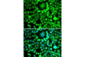 Immunofluorescence analysis of MCF-7 cells using BLID antibody. (BLID Antikörper  (AA 1-108))