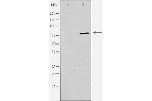 Western blot analysis of extracts from Jurkat cells, using SLC6A15 antibody. (SLC6A15 Antikörper  (N-Term))