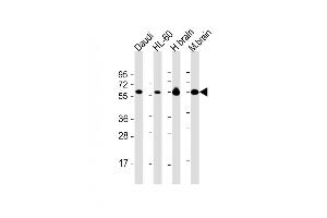 Western Blotting (WB) image for anti-Protein Kinase C and Casein Kinase Substrate in Neurons 2 (PACSIN2) (AA 250-486) antibody (ABIN6242514)