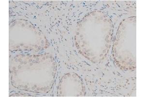 ABIN6267395 at 1/200 staining Human prostate tissue sections by IHC-P. (GATA1 Antikörper  (pSer142))