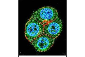 Confocal immunofluorescent analysis of BTRC Antibody (N-term) (ABIN655814 and ABIN2845238) with ZR-75-1 cell followed by Alexa Fluor 488-conjugated goat anti-rabbit lgG (green). (BTRC Antikörper  (N-Term))