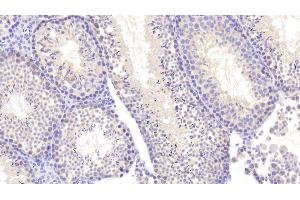 Detection of NEIL3 in Mouse Testis Tissue using Polyclonal Antibody to Nei Endonuclease VIII Like Protein 3 (NEIL3) (NEIL3 Antikörper  (AA 2-187))