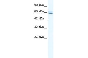 CBFA2T3 Antikörper  (N-Term)