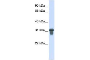 SLC25A11 antibody used at 1 ug/ml to detect target protein. (SLC25A11 Antikörper)