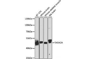 Western blot analysis of extracts of various cell lines using TADA2A Polyclonal Antibody at dilution of 1:1000. (TADA2L Antikörper)