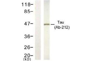 Image no. 1 for anti-Microtubule-Associated Protein tau (MAPT) (Thr212) antibody (ABIN197504) (MAPT Antikörper  (Thr212))