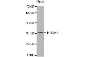 Western Blotting (WB) image for anti-Homeobox A11 (HOXA11) antibody (ABIN1873073) (Homeobox A11 Antikörper)