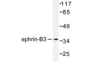 Image no. 1 for anti-Ephrin B3 (EFNB3) antibody (ABIN265403) (Ephrin B3 Antikörper)