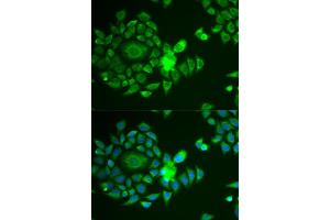 Immunofluorescence analysis of U2OS cells using NDUFS4 antibody (ABIN6132404, ABIN6144488, ABIN6144490 and ABIN6217547).