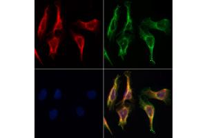 ABIN6258273 and ABIN6274214 staining Hela by IF/ICC. (MARK3 Antikörper  (N-Term))