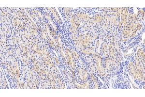 Detection of Slit2 in Human Kidney Tissue using Polyclonal Antibody to Slit Homolog 2 (Slit2) (SLIT2 Antikörper  (AA 664-777))
