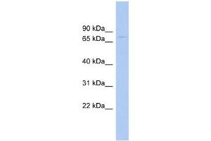RAD17 antibody used at 1 ug/ml to detect target protein. (RAD17 Antikörper)