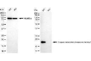 Western blotting analysis using copper metabolism domain containing 1 antibody (ABIN7798153).