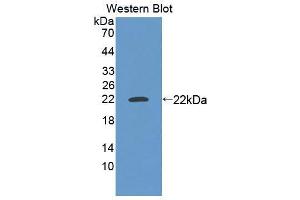 Western blot analysis of the recombinant protein. (MEF2A Antikörper  (AA 1-162))