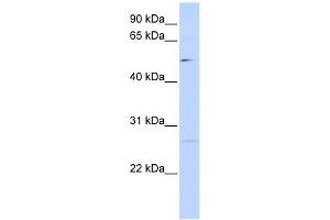 PPM1M antibody used at 1 ug/ml to detect target protein. (PPM1M Antikörper)