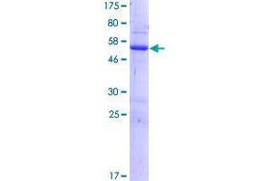 RASSF3 Protein (AA 1-238) (GST tag)