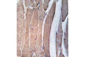 Formalin-fixed and paraffin-embedded human skeletal muscle tissue reacted with DAPK2 Antibody (N-term) , which was peroxidase-conjugated to the secondary antibody, followed by DAB staining. (DAPK2 Antikörper  (N-Term))