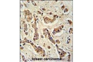 Immunohistochemistry (Paraffin-embedded Sections) (IHC (p)) image for anti-Family with Sequence Similarity 20, Member A (FAM20A) (AA 48-77), (N-Term) antibody (ABIN651160)