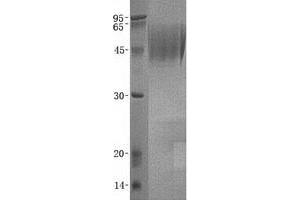 Western Blotting (WB) image for Tumor Necrosis Factor Receptor Superfamily, Member 10c (TNFRSF10C) protein (ABIN2713567)