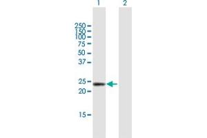Western Blot analysis of DMRTB1 expression in transfected 293T cell line by DMRTB1 MaxPab polyclonal antibody. (DMRTB1 Antikörper  (AA 1-189))