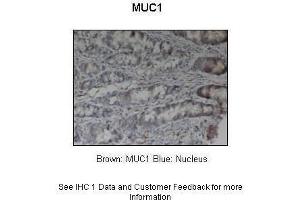 Sample Type :  Pig stomach  Primary Antibody Dilution :  1:200  Secondary Antibody :  Anti-rabbit-HRP  Secondary Antibody Dilution :  1:1000  Color/Signal Descriptions :  Brown: MUC1 Blue: Nucleus  Gene Name :  MUC1  Submitted by :  Dr. (MUC1 Antikörper  (Middle Region))