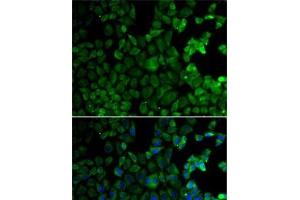 Immunofluorescence analysis of HeLa cells using MSR1 Polyclonal Antibody (Macrophage Scavenger Receptor 1 Antikörper)
