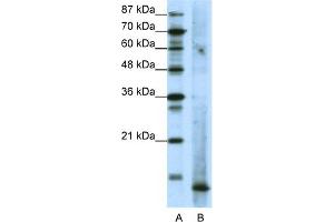 WB Suggested Anti-MDS1 Antibody Titration:  1. (MECOM Antikörper  (N-Term))