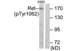 Western blot analysis of extracts from K562 cells, using Ret (Phospho-Tyr1062) Antibody. (Ret Proto-Oncogene Antikörper  (pTyr1062))